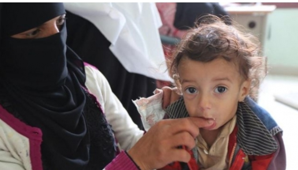 اليونسيف تعلن حاجتها 484.4 مليون دولار في 2022 من اجل الاستجابة لاحتياجات الطفولة في اليمن