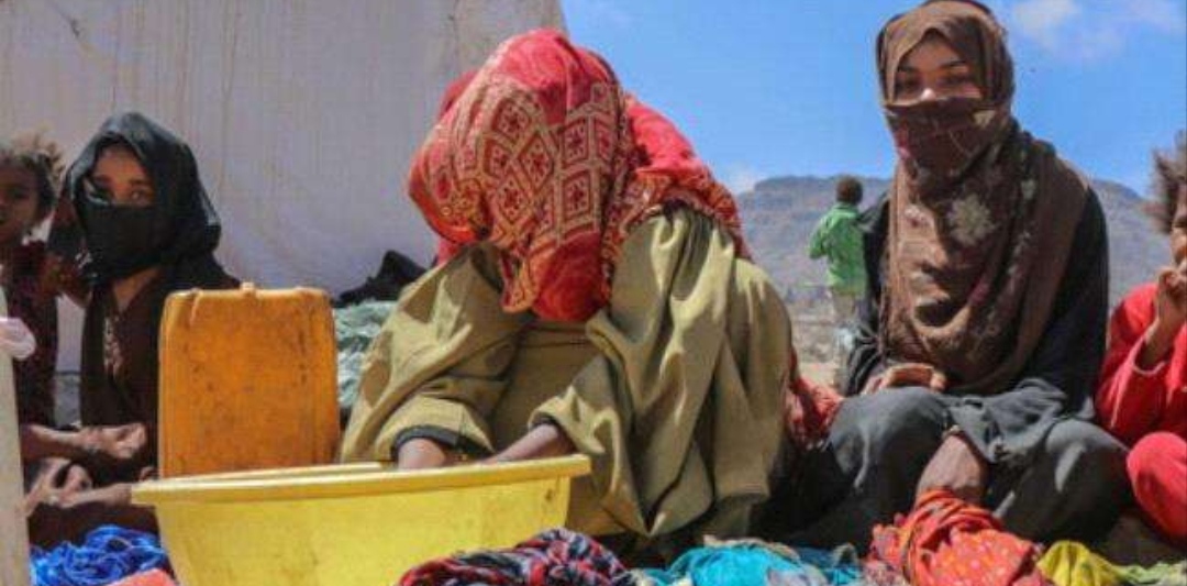 الأمم المتحدة: الجوع في اليمن في أعلى مستوياته منذ 2015